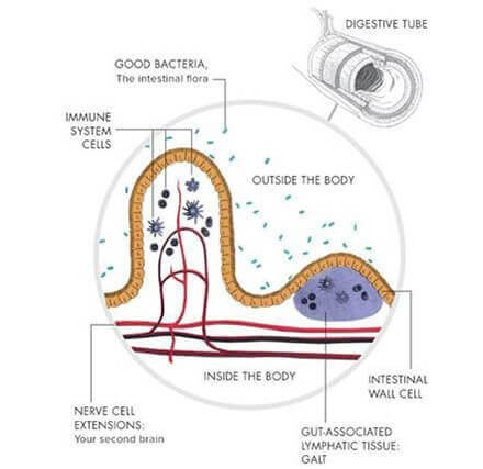 Leaky Gut