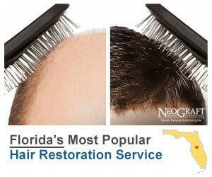NeoGraft Hair Restoration Orlando FL