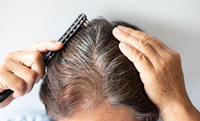 Hair Restoration Clinic Altamonte Springs FL